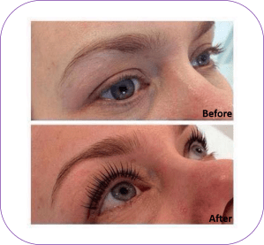 LVL Ballymena Before and After