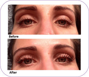 LVL Ballymena Before and After