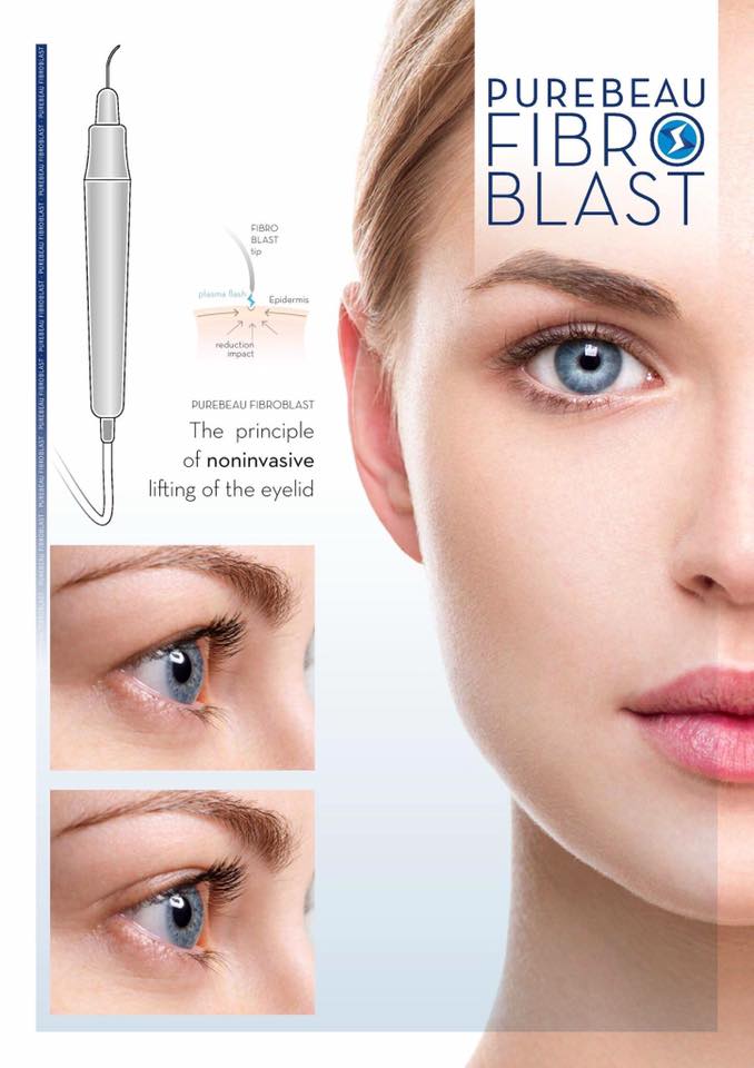 Fibroblast Ballymena