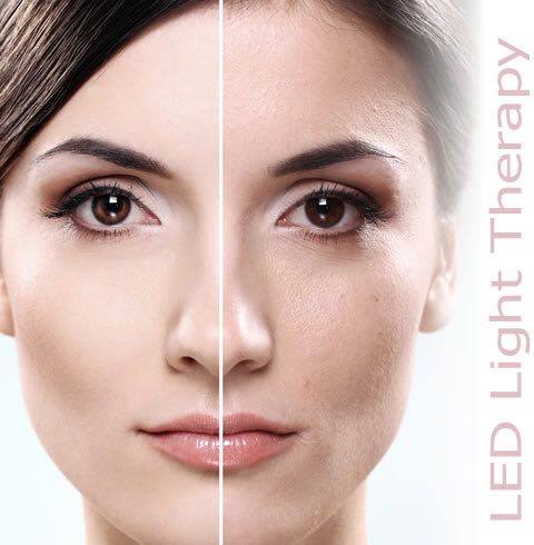 light-therapy-facial-before-and-after